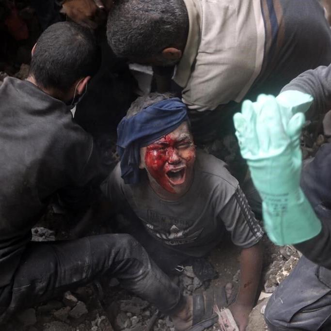 Following an Israeli airstrike, crowded Gaza hospital struggles to treat wounded children